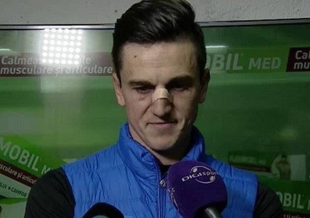 Florin Gardoș are fractură de piramidă nazală